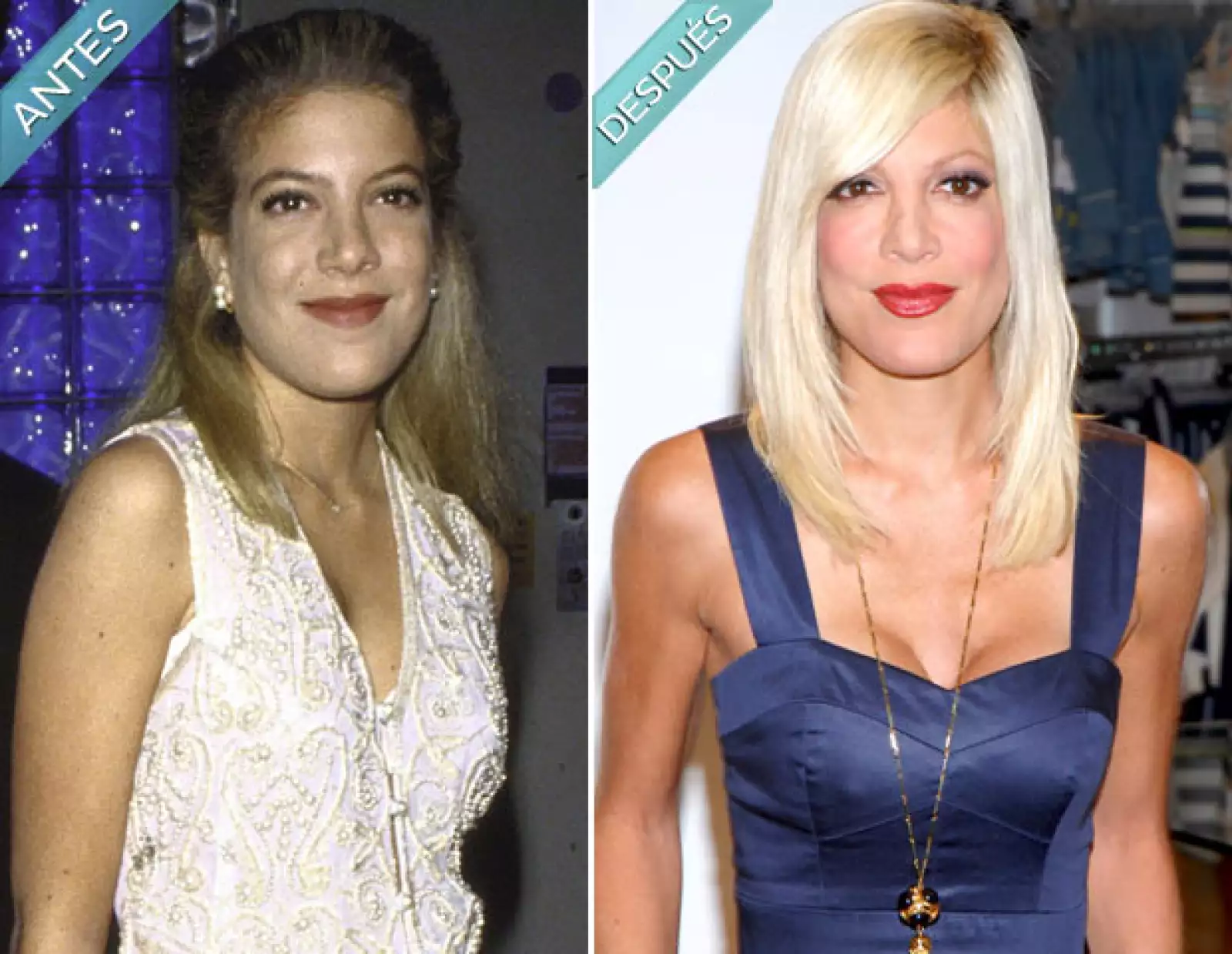Tori Spelling ha hecho lo posible por cambiar, desde implante de pecho, pasando por la barbilla y pómulos.