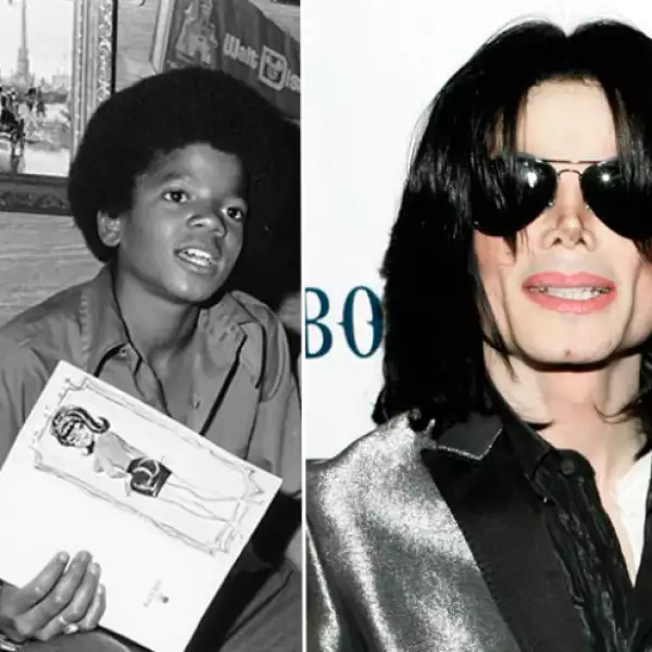 Michael Jackson es el mejor ejemplo de una transformación. El doctor Wallace Goodstein, quien lo asistió durante los 90, aseguró que entraba a la clínica una vez cada dos meses y se hizo entre 10 y 12 cirugías solo en el tiempo que él estuvo allí.