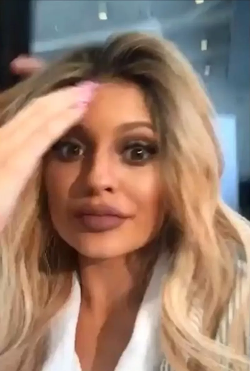 Kylie ha causado sensación en las redes sociales con su nuevo look, que no ha sido del agrado para todos, pues algunos argumentan que “ha ido demasiado lejos” con éste.