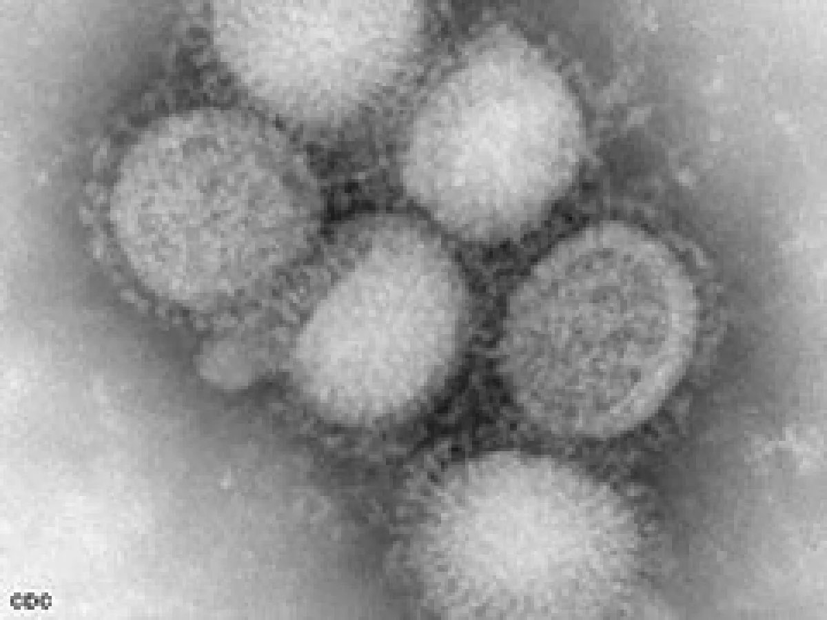 Imagen preliminar del virus de la influenza porcina. (Foto: CDC)