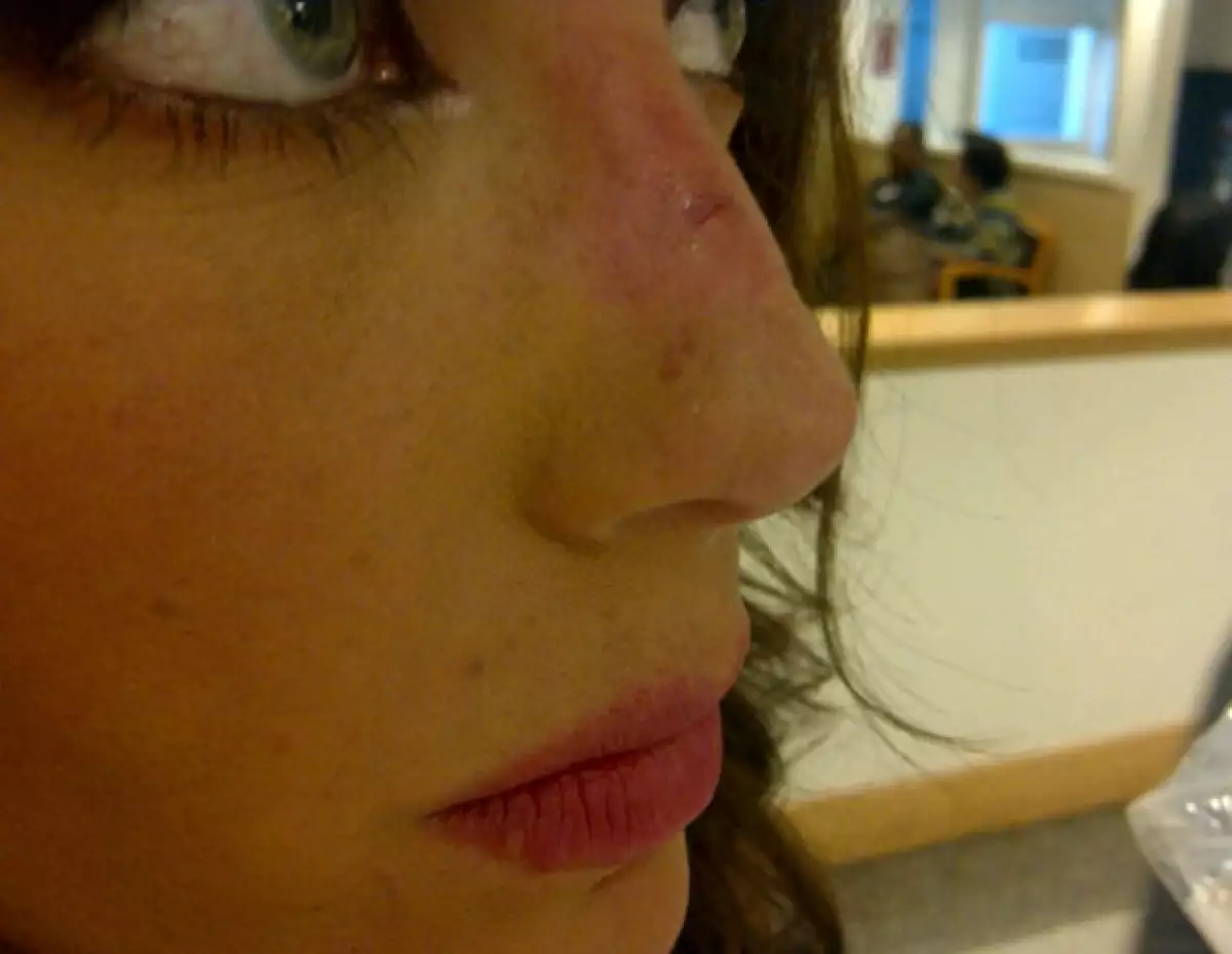 Anahí compartió con sus seguidores esta foto del golpe que se dio.