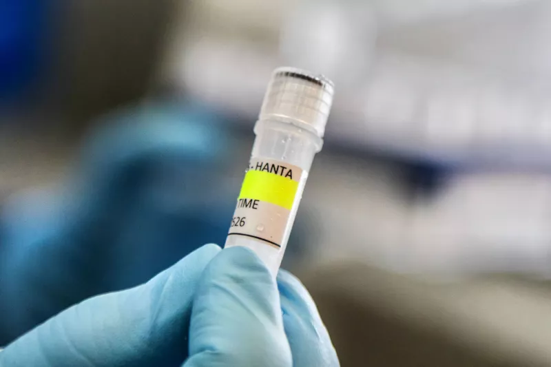 Este folleto publicado por el Ministerio de Salud de Argentina muestra a un científico del Instituto Malbr·n sosteniendo un contenedor utilizado para diagnosticar el hantavirus de los Andes, que contiene ARN del virus de los Andes como parte del proceso de detección, en Buenos Aires el 6 de mayo de 2026. Argentina ha visto un aumento en los casos de hantavirus, pero no un brote, dijo un experto a la AFP el 6 de mayo, ya que las infecciones a bordo de un crucero han provocado un susto de salud mundial.