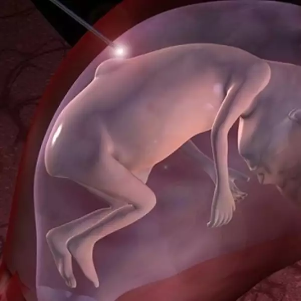 Bebe utero representacion