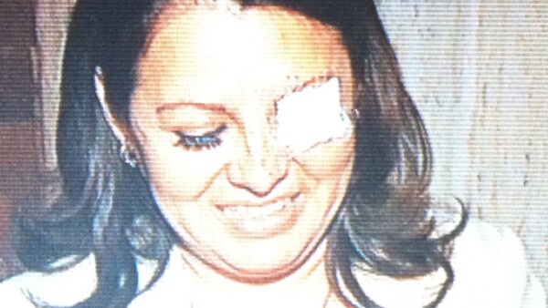 Karen Quiroga, diputada perredista, tuvo un altercado con la diputada Landy Berzunza (en la foto), del PRI, quien tuvo una herida al interior de su ojo tras los arañazos y empujones.