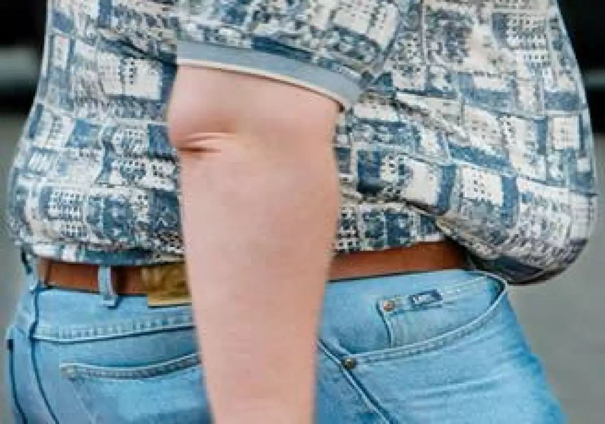 obesidad_gordo