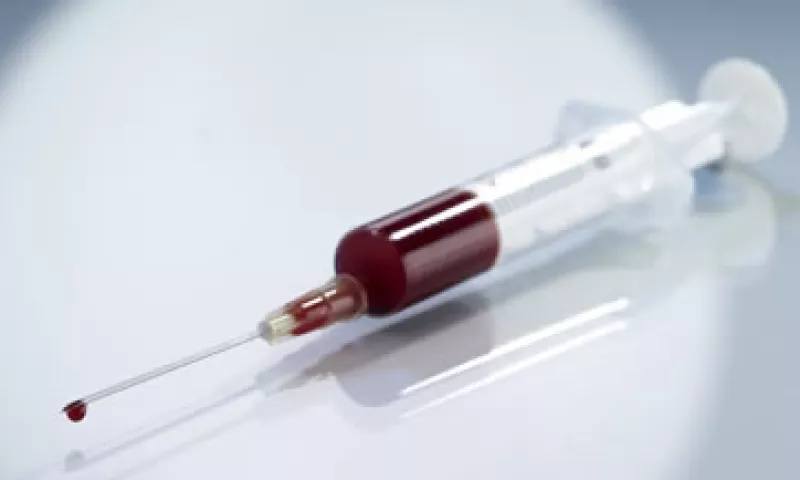 La perforación que se genera con el nuevo producto es muy pequeña, el equipo es compacto y no requiere de mantenimiento continuo. (Foto: Photos to Go)