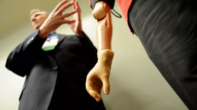 brazo_bionico_protesis