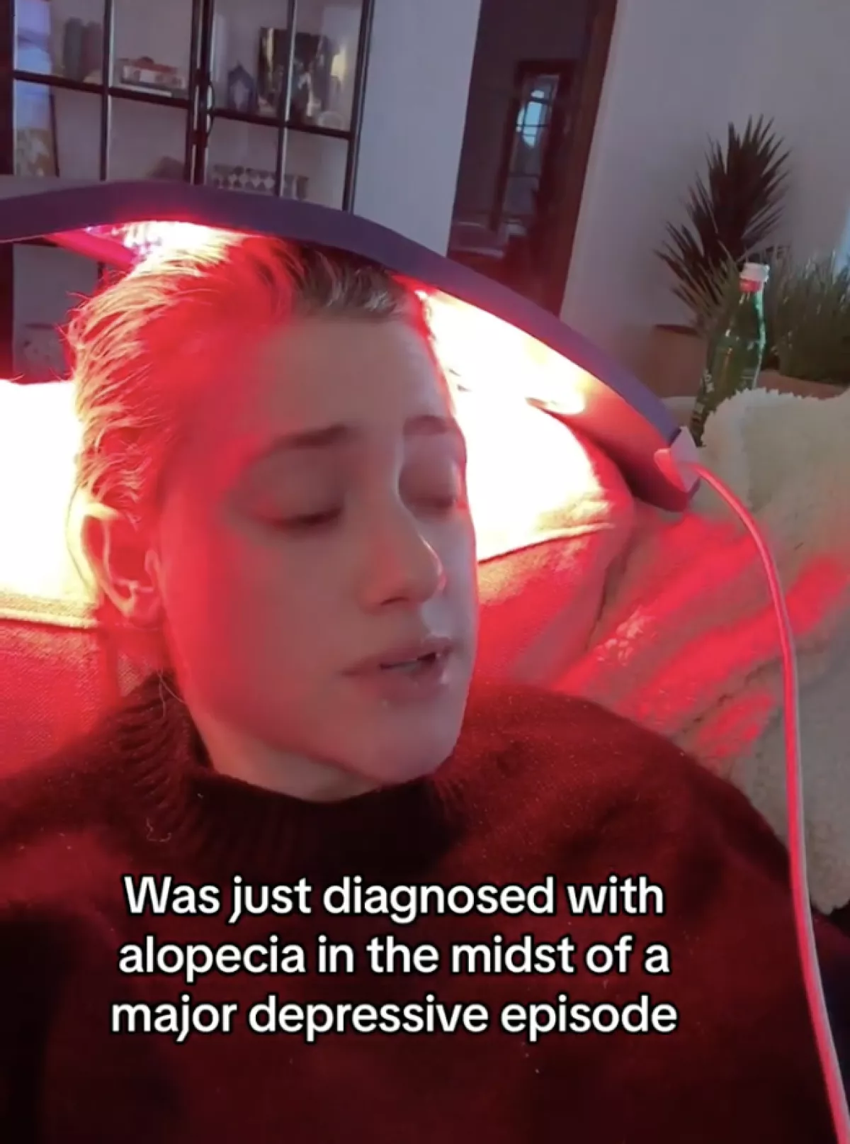 Lili Reinhart recibe tratamiento contra la alopecia.