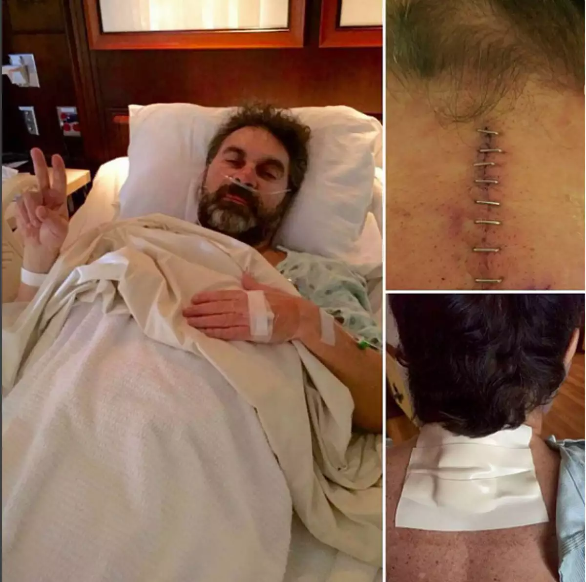 Mijares mostró en foto su herida tras la cirugía.