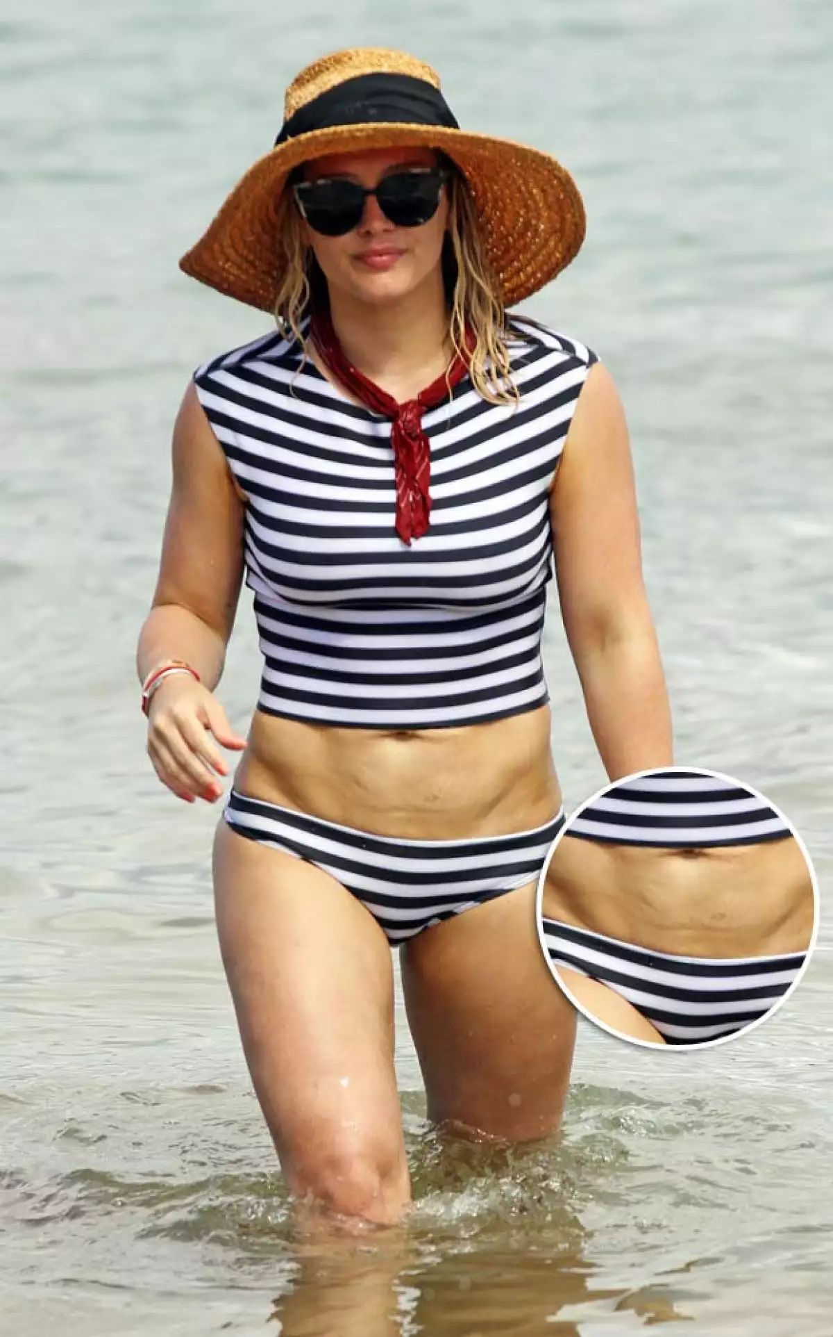 El abdomen de Hilary.