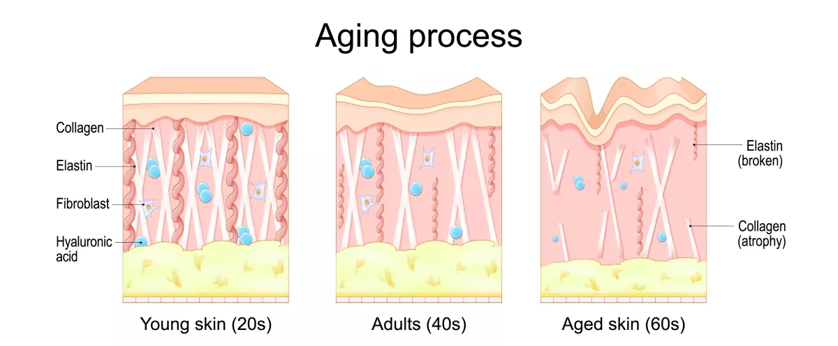 Aging,Process.,Comparison,Of,Young,,Adults,And,Aged,Skin.,Collagen,