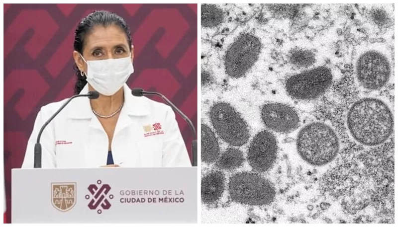 viruela del mono cdmx