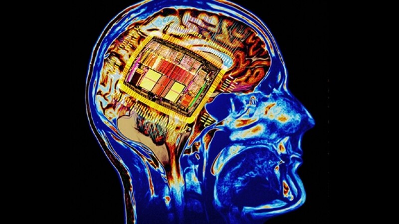 cerebro