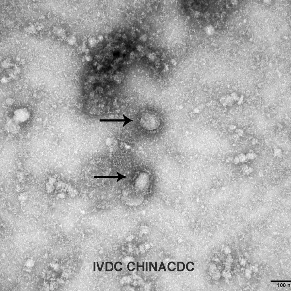 A Transmission Electron Microscopy image of the first isolated case of the coronavirus