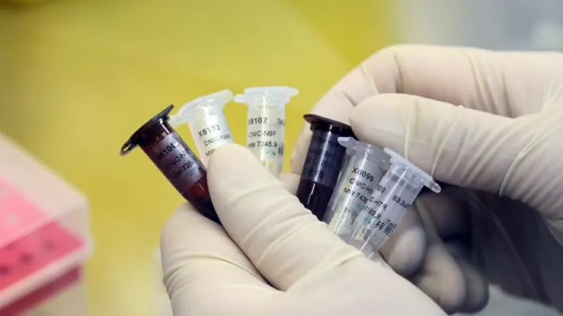 gripe aviar pruebas sangre bird flu