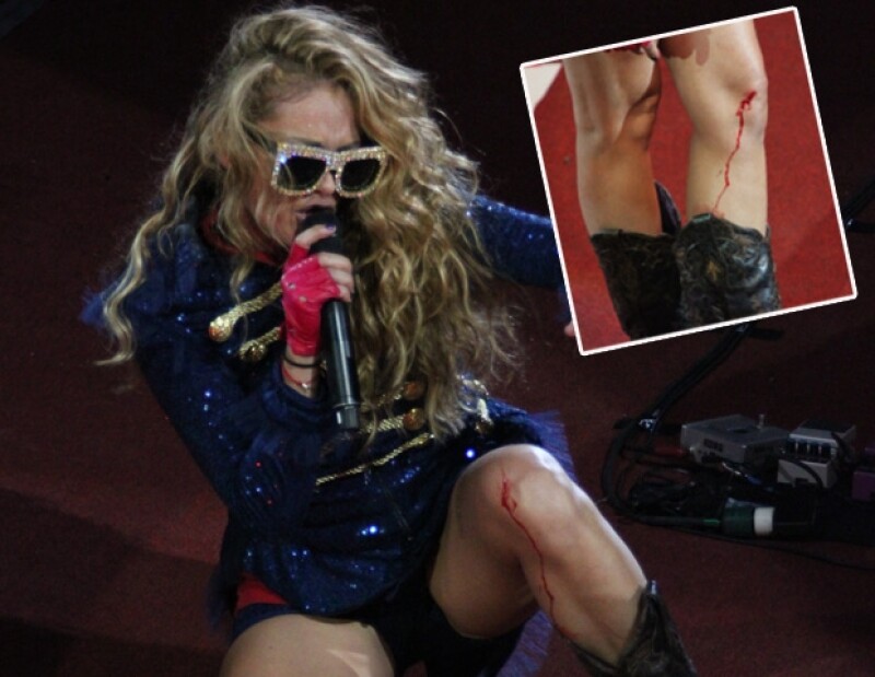 Paulina Rubio se abrió la rodilla al hincarse durante su concierto en el Palenque de León, Guanajuato. A pesar de la lesión, su energía no se vio afectada y de inmediato fue auxiliada por su staff.