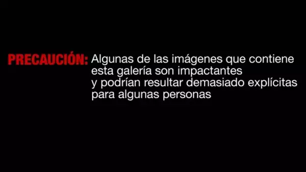 Advertencia fotogalería explícita