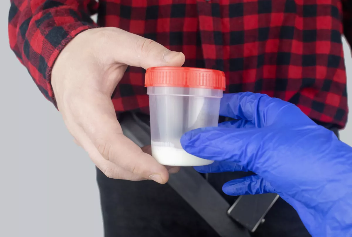 Man takes semen analysis. Spermogram. Concept. Male with his pants unbuttoned symbolizes preparation for analysis of seed for infertility, sperm motility. Suitability test for artificial insemination