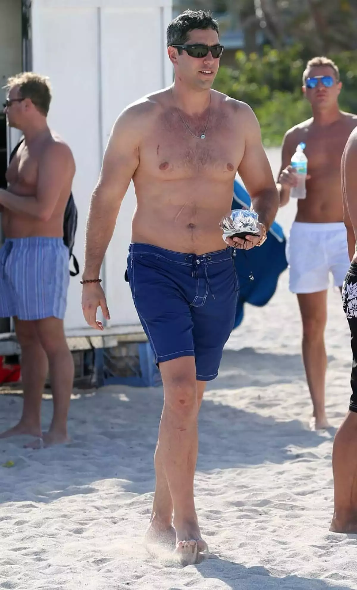 Nick Loeb en Miami y algunos rasguños en el cuello, pecho y rodilla.