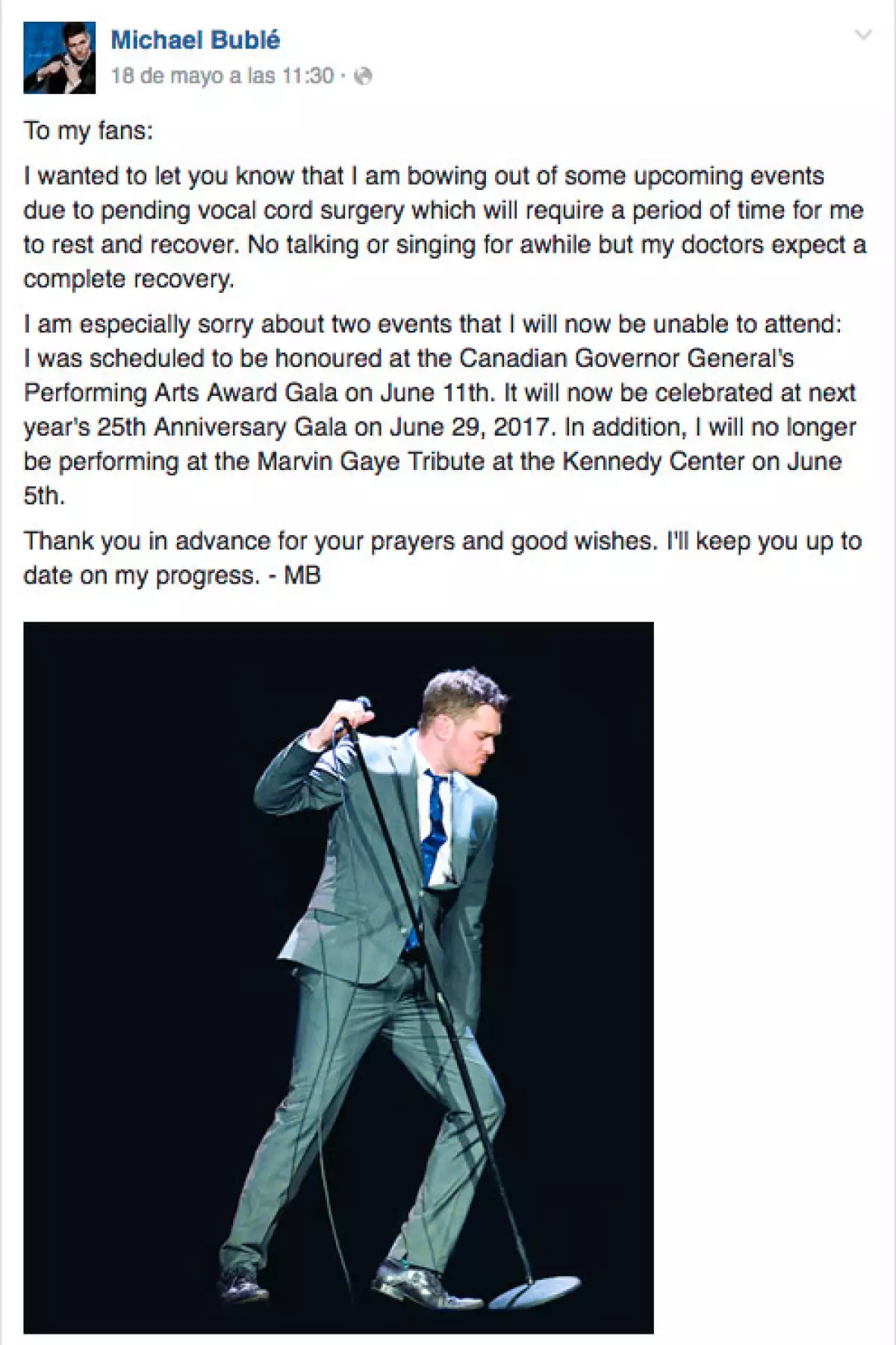 Este es el post con el que el cantante canadiense anunció su retiro temporal de los escenarios.