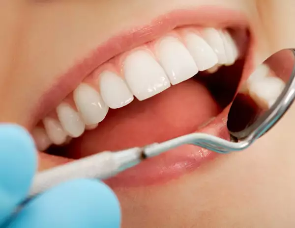 El exceso de azúcar puede provocar diabetes, cambio de peso y caries.