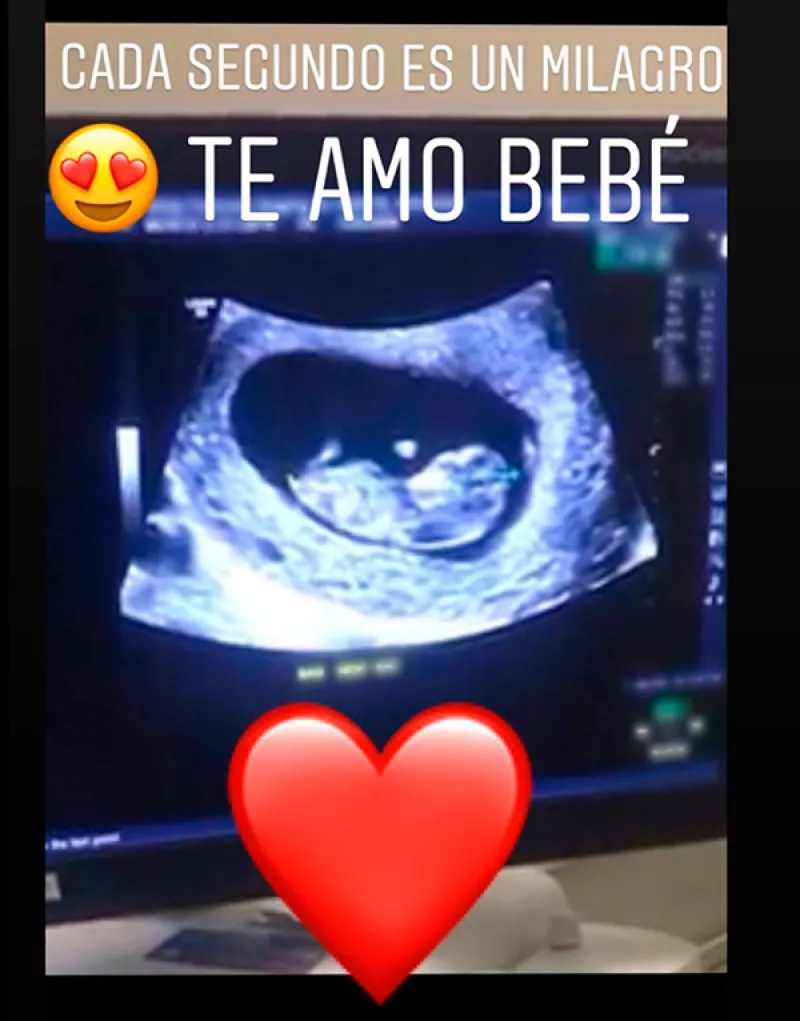 Ultrasonido de Anahí