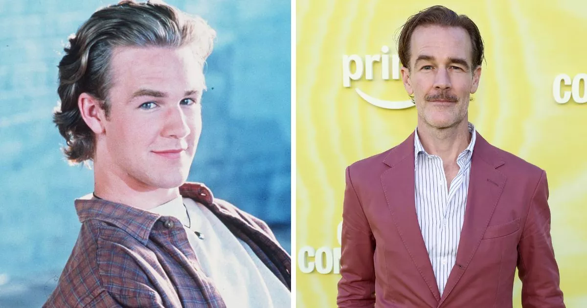 James-Van-Der-Beek-Antes-Despues.jpg