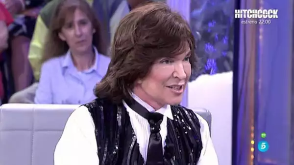 En su paso por Chile, el cantante desmintió, en conferencia de prensa, los rumores que comenzaron a circular sobre el cambio drástico en su rostro.