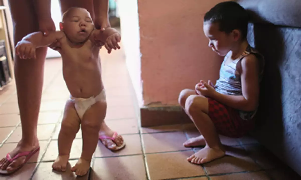 El zika daña las neuronas del feto durante su gestación. (Foto: Getty Images)