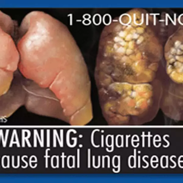 Las explícitas fotos buscan ilustrarle al consumidor los efectos nocivos de fumar.
