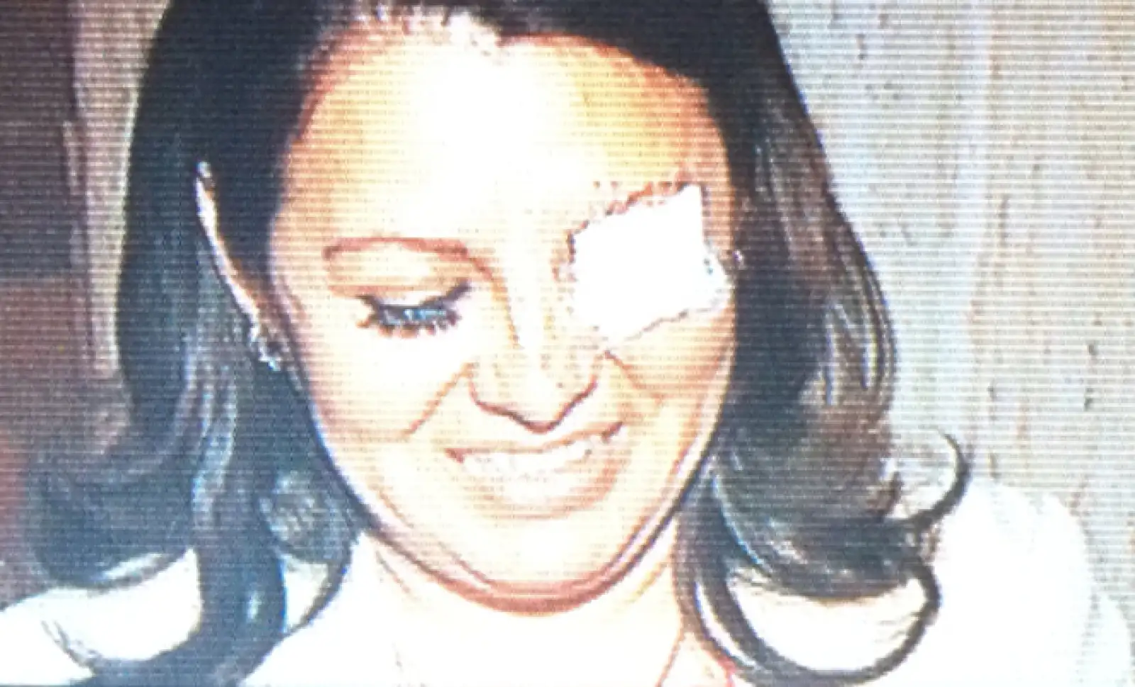 Karen Quiroga, diputada perredista, tuvo un altercado con la diputada Landy Berzunza (en la foto), del PRI, quien tuvo una herida al interior de su ojo tras los arañazos y empujones.