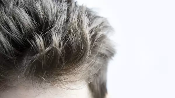 Male head with lush erect hair.