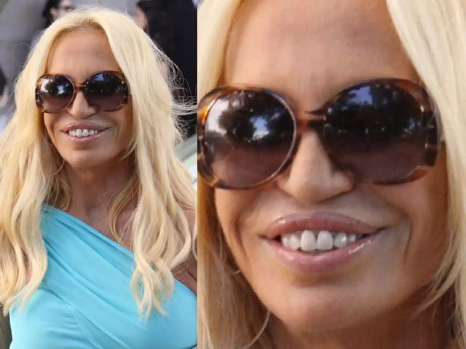 Donatella Versace en lugar de encantar con su sonrisa desencanta. Tiene los dientes demasiado grandes al igual que su boca, lo que hace que tenga una sonrisa muy poco agradable.