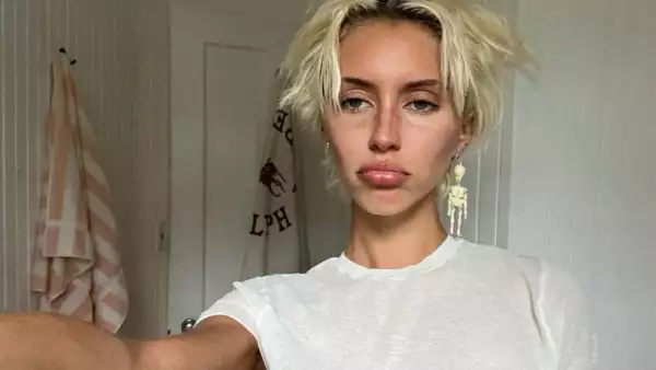 riesgos-hielo-en-la-cara