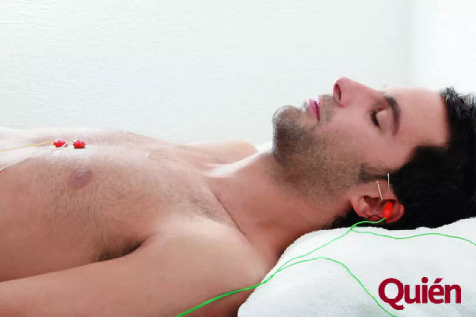 Electroacupuntura Ap