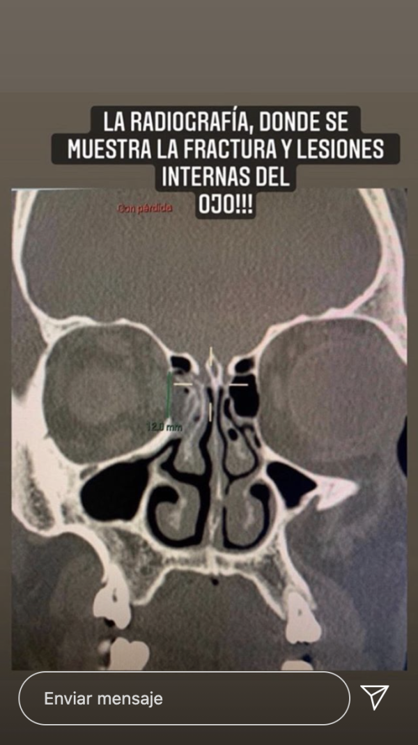 Instagram de Eduardo Marban