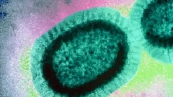 Sanofi-Pasteur produce vacunas contra diversos tipos de influenza. (Foto: Cortesía Sanofi-Aventis)