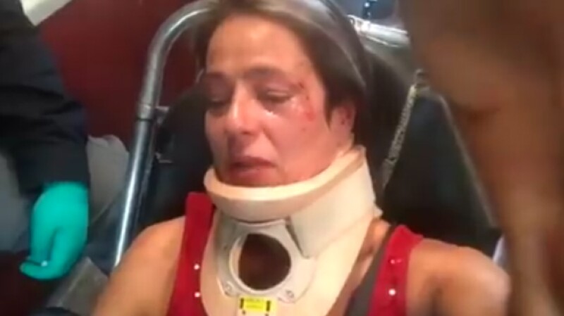 América Gabriel publicó un par de videos en Instagram del hombre que la agredió luego de que ella le pidiera alzar el excremento de su perro mientras paseaba en Parque México, en la Condesa.