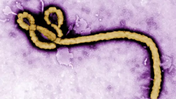 El laboratorio estadounidense está en un programa gubernamental que busca una cura del ébola. (Foto: Reuters)