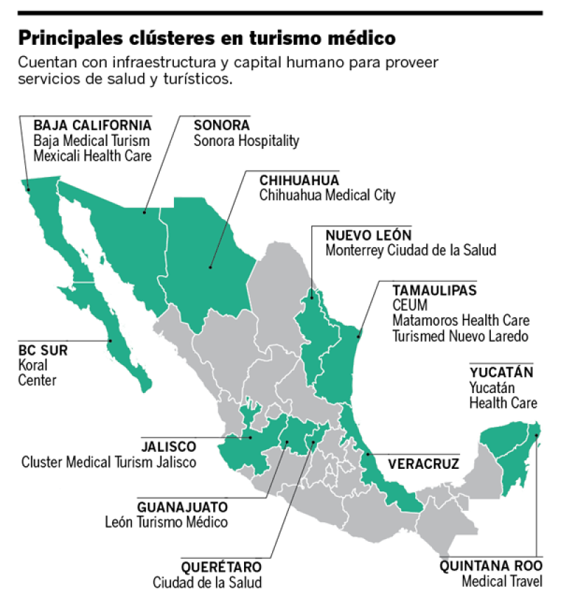 El modelo de clusters