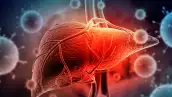 hepatitis infantil aguda muerte hidalgo