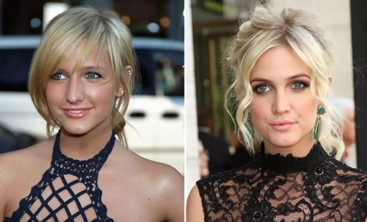 La hermana de Jessica Simpson hizo un retoque a su nariz, lo que le hizo lucir un rostro más afilado.