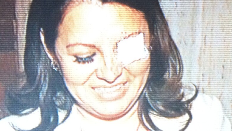 Karen Quiroga, diputada perredista, tuvo un altercado con la diputada Landy Berzunza (en la foto), del PRI, quien tuvo una herida al interior de su ojo tras los arañazos y empujones.