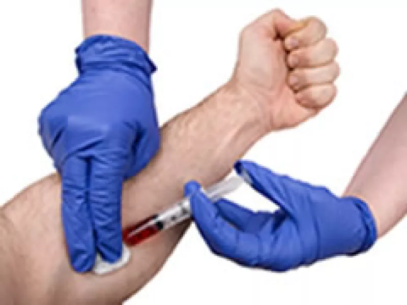 Según la OMS, se han registrado 800 casos humanos de influenza en México, que incluyen 60 muertes. (Foto: Archivo)