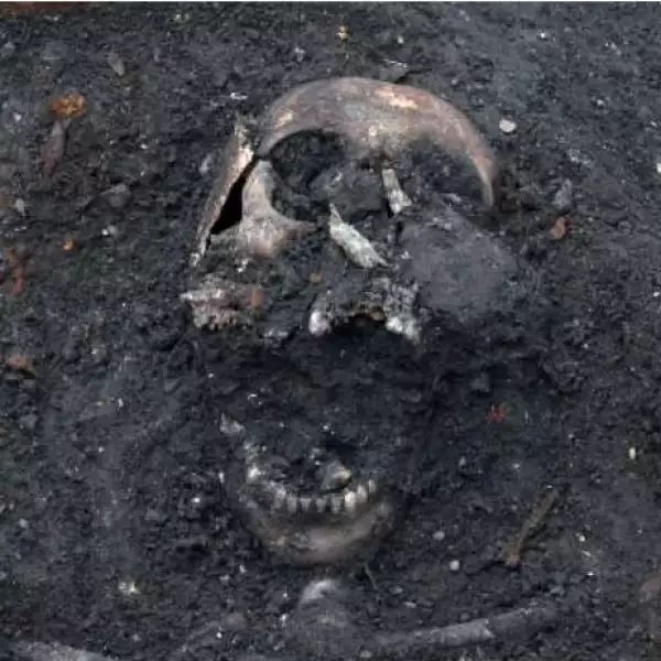 Esqueletos Londres 2