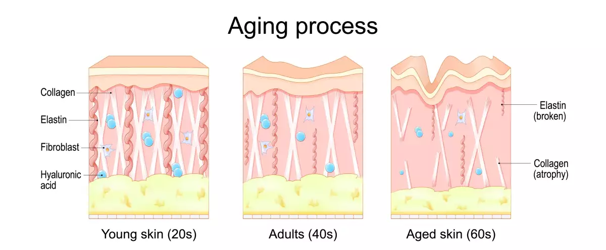 Aging,Process.,Comparison,Of,Young,,Adults,And,Aged,Skin.,Collagen,