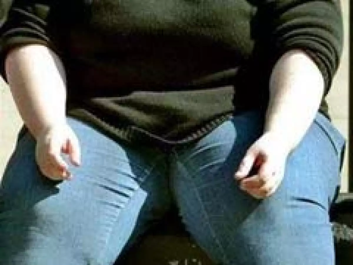 Lucha contra la obesidad en Gran Bretaña. (Foto: Archivo)