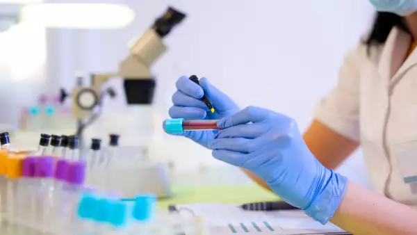 estudios laboratorio