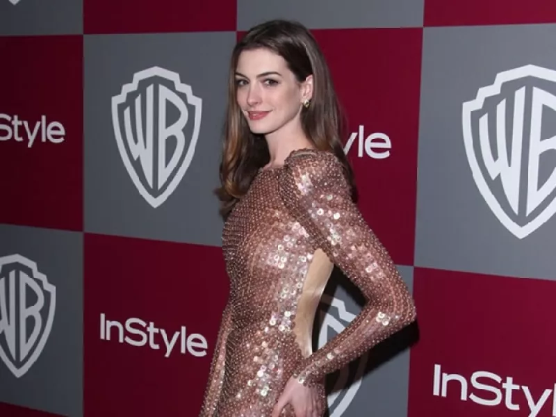 Michelle Pfeiffer, Halle Berry y ahora Anne Hathaway son las actrices que personifican a Catwoman. Chécate a estas sexys `gatitas´. Habrá que ver si Anne logra mejorar este grado de sensualidad.