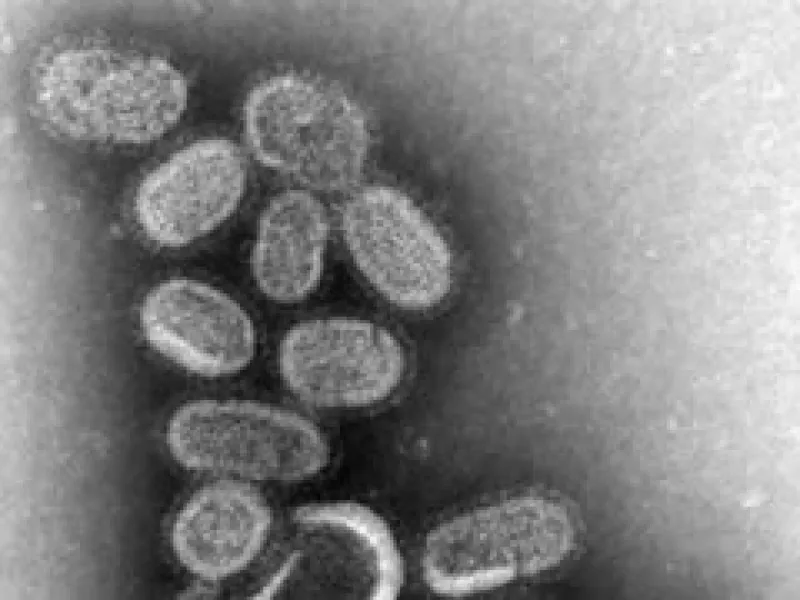 EU confirma más personas contagiadas por influenza (Foto: Archivo)